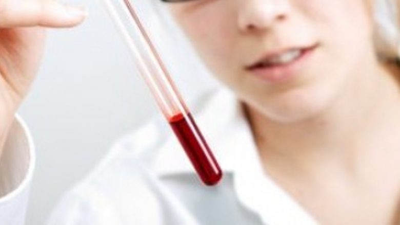 Impactul Grupei Sanguine Asupra Sănătății: Ce Boli Poți Dezvolta în Funcție de Grupa de Sânge