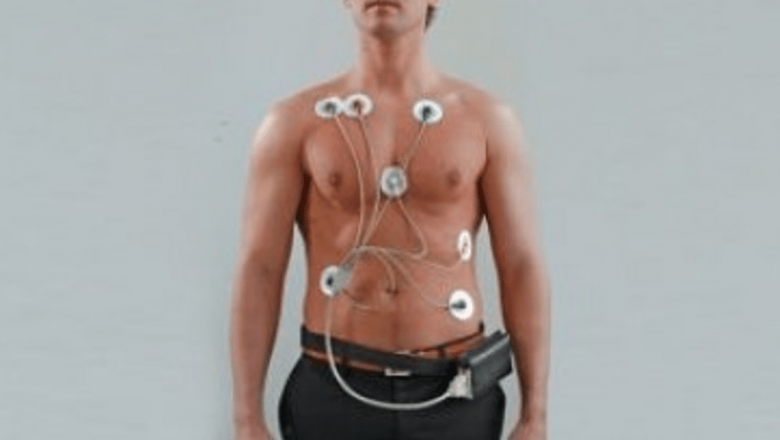 Monitorizarea Holter: O Privire Detaliată Asupra Importanței și Utilizării Sale în Evaluarea Sănătății Cardiace