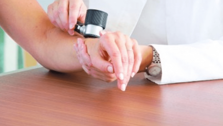 Alunițele de pe brațe: Un indicator surprinzător al riscului de cancer de piele