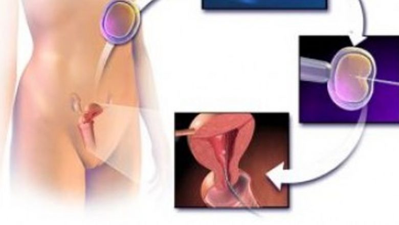Fertilizarea in Vitro: Ghid Complet al Procesului și Implicațiile Sale