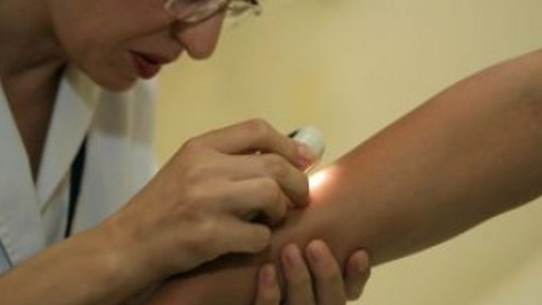Românii și Dermatologia: O Prioritate Ignorată în Fața Riscurilor de Sănătate