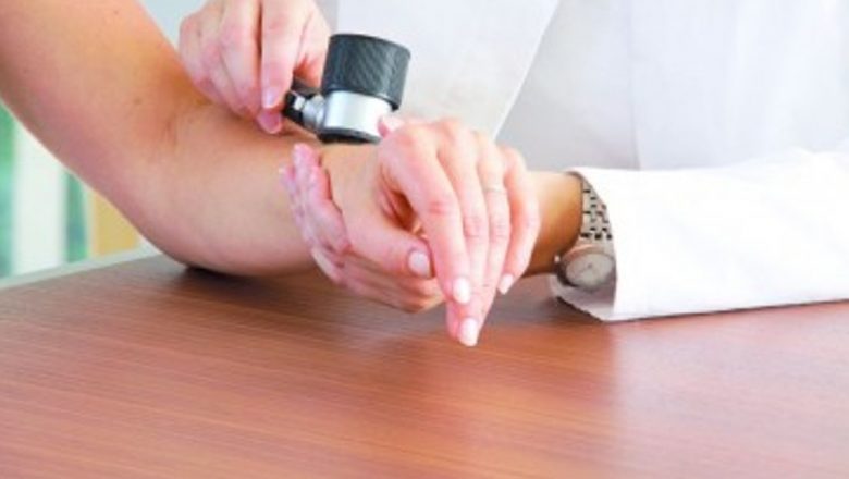 Revoluția în Tratamentul Cancerului de Piele: Pembrolizumab și Impactul său Asupra Pacienților