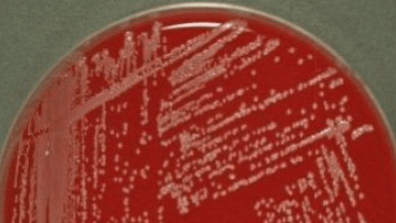 Descoperirea Revoluționară: Bacteriile Comunicând ca Neuronii Umani