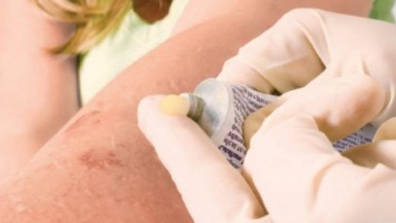 Ghid Complet pentru Primul Ajutor în Cazul Arsurilor: Cum Să Reacționezi Corect și Eficient