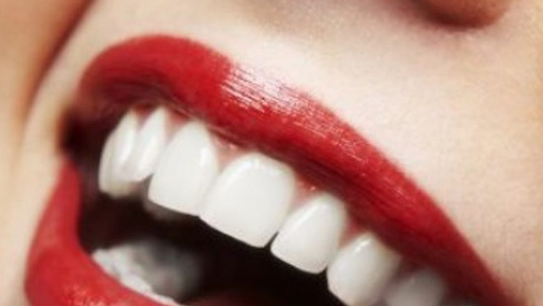 Cum să Scapi de Tartru și Să Redai Strălucirea Dinților Tăi: Ghid Complet pentru Îngrijirea Orală