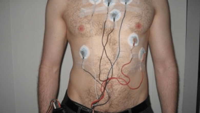 Holter ECG: Monitorizarea Continuă a Sănătății Cardiace