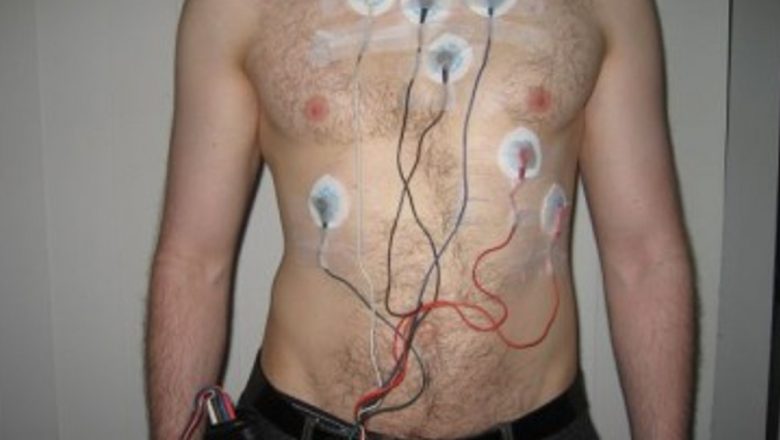Holter ECG: Instrumentul Esențial pentru Monitorizarea Sănătății Cardiace