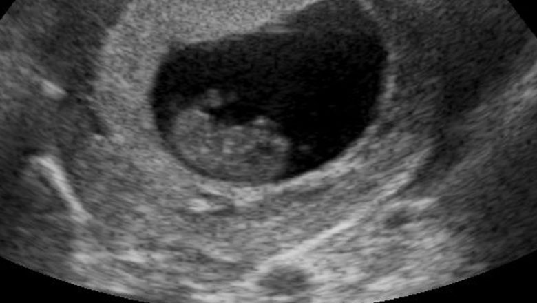 Strategii Eficiente pentru Creșterea Șanselor de Concepție: Ghidul Complet al Fertilității