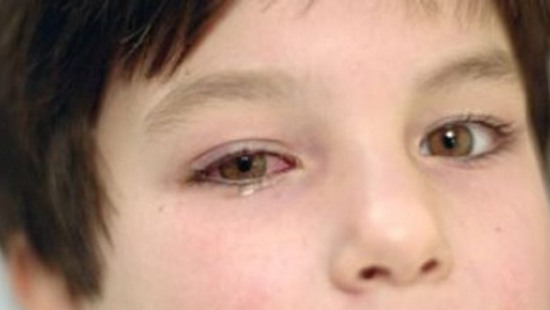 Cum să protejăm copiii de alergiile oculare de primăvară: Ghid complet pentru părinți