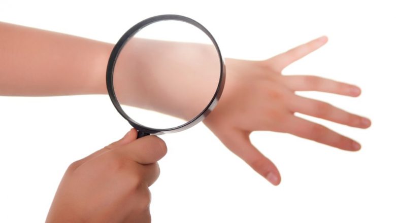 Semnele care indică necesitatea unei vizite la dermatolog: Ce trebuie să știi pentru sănătatea pielii tale