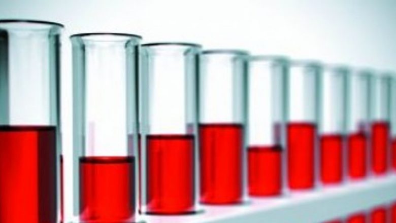 Importanța cunoașterii grupei sangvine: Implicații medicale și sociale