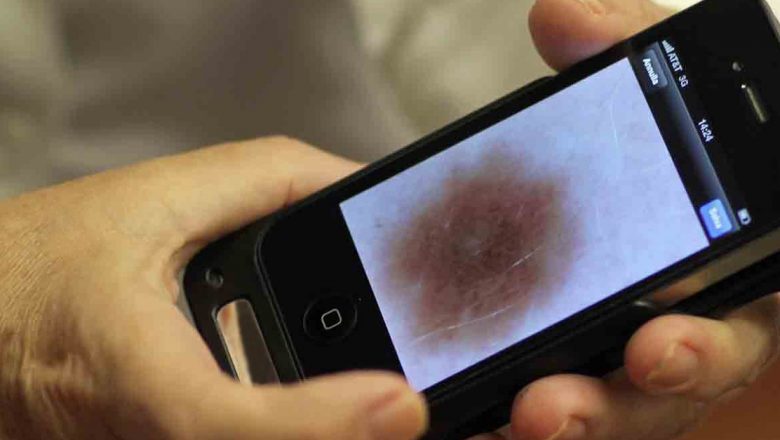 Telefoanele Mobile și Cancerul: Ce Spun Medicii și Studiile Recente