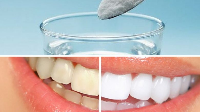Remedii Naturale pentru Igiena Dentară: Cum să Îți Faci Apa de Gură Acasă