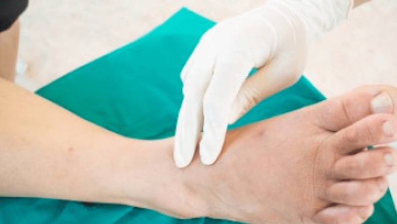 Înțelegerea Neuropatiei Diabetice Periferice: Cauze, Simptome și Măsuri de Prevenire prin Suplimentele Favio