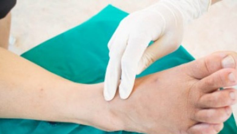 Înțelegerea neuropatiei diabetice periferice și rolul multivitaminelor în prevenirea acesteia