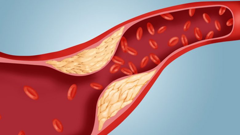 Ghidul alimentar pentru gestionarea colesterolului: Ce să mănânci și ce să eviți