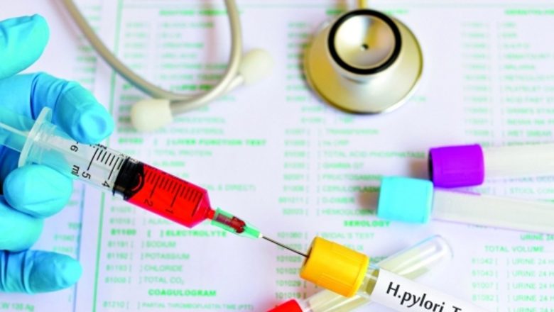 Diagnosticarea bolilor digestive: Analize esențiale pentru sănătatea stomacului