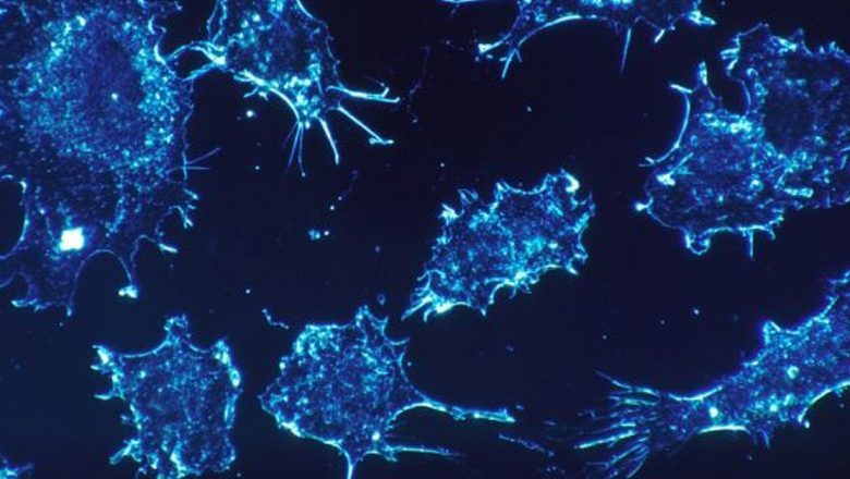 Efectele Combinației de Lămâie și Bicarbonat de Sodiu asupra Celulelor Canceroase: O Analiză Detaliată