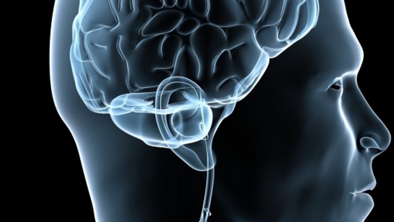 Prevenirea atacului cerebral: Măsuri esențiale pentru un creier sănătos