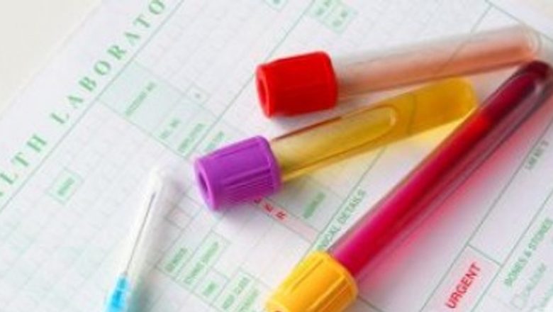 Proteina C reactivă: Indicator al sănătății și al riscurilor medicale