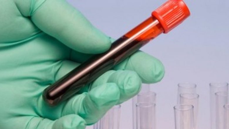Importanța Donării de Sânge: O Inițiativă Vitală pentru Comunitate