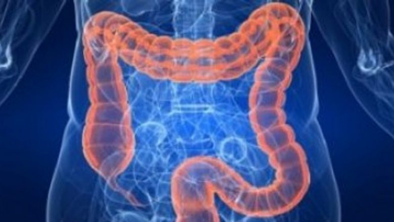 Ghid Complet pentru Curățarea Naturală a Colonului: Alimentație, Suplimente și Prevenție