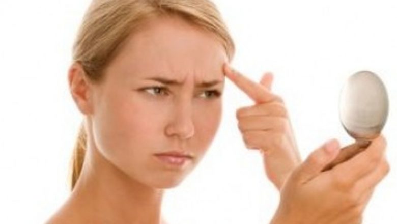 Acneea: O Fereastră către Sănătatea Tiroidiană și Alte Probleme de Sănătate