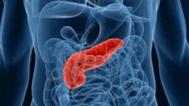 Semnele Precursorilor Cancerului Pancreatic: Ce Trebuie Să Știi pentru a Te Proteja