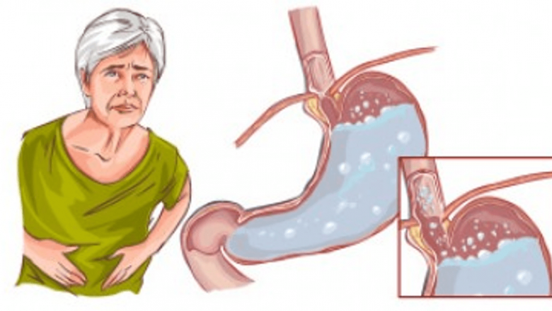 Gripa la stomac: Tot ce trebuie să știi despre gastroenterită și impactul său asupra sănătății