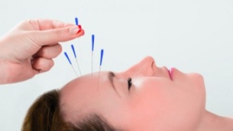 Descoperirea Acupuncturii: O Privire Detaliată Asupra Beneficiilor și Funcționării Sale