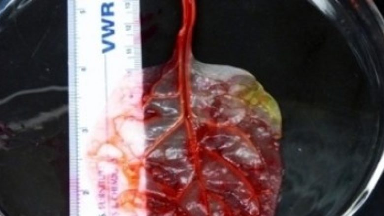 Frunza de spanac, un nou erou în medicina regenerativă: Cum o inovație științifică poate transforma viitorul sănătății inimii