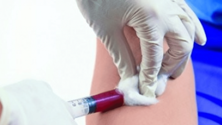 Importanța Proteinei C Reactive: Rolul său în Diagnosticul și Monitorizarea Inflamației