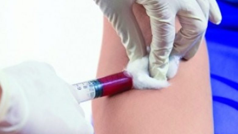 Importanța Proteinei C Reactive: Un Indicator Esențial în Diagnosticul Inflamațiilor
