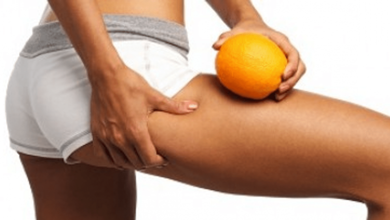 Cele mai eficiente soluții împotriva celulitei: Analiză detaliată a celor mai bune creme și remedii naturale
