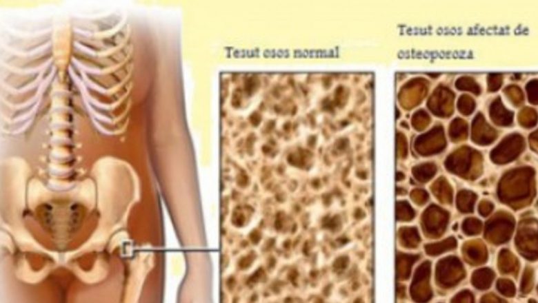 Cum să-ți menții rezistența oaselor: Strategii de nutriție și exerciții pentru o sănătate optimă