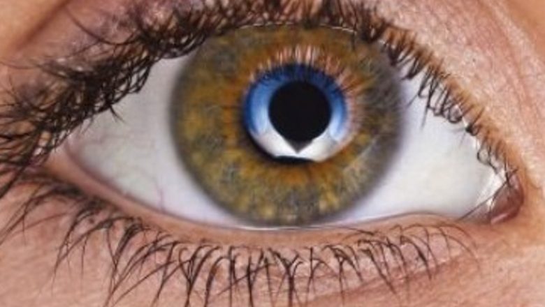 Extensiile de Gene: Beneficii, Contraindicații și Impactul Asupra Sănătății Oculare