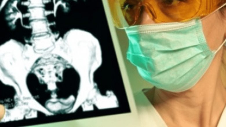 Urografia intravenoasă: O privire detaliată asupra sănătății rinichilor și a căilor urinare