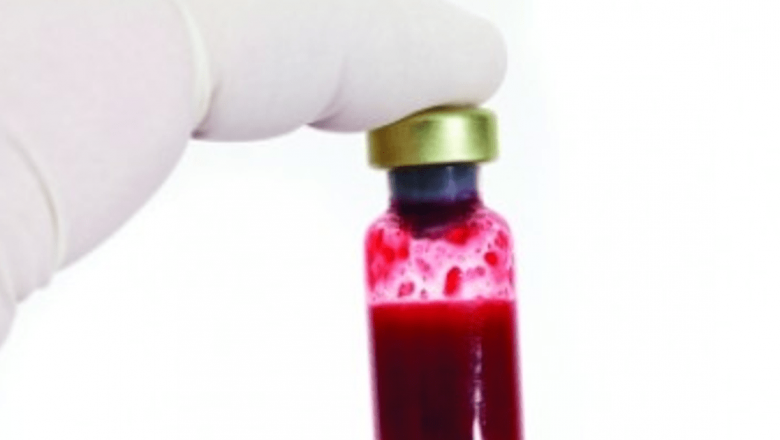 Anticoagulante și Diuretice: Rolul Esențial în Tratamentul Afecțiunilor Cardiovasculare și Renale