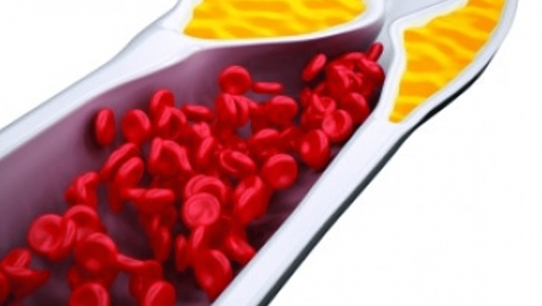 Statinele: O Armă Eficientă Împotriva Colesterolului și a Riscurilor Cardiovasculare