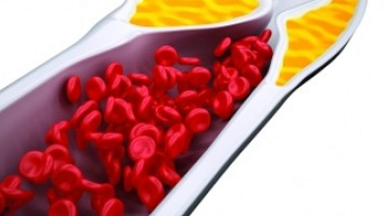 Statinele: O privire detaliată asupra rolului lor în combaterea colesterolului