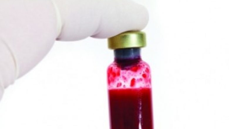 Anticoagulante și diuretice: Indicații, implicații și considerații esențiale pentru sănătate