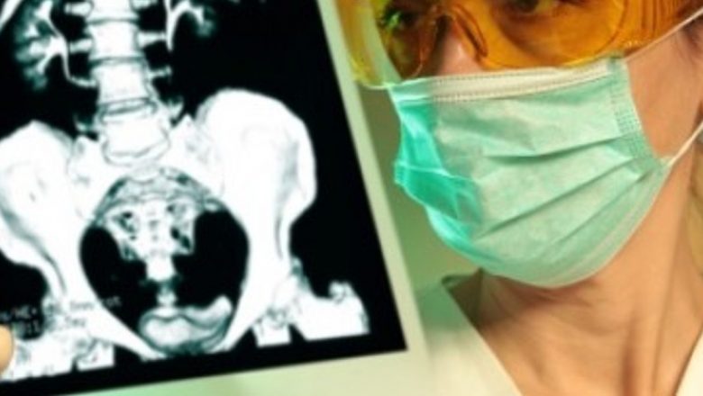 Urografia intravenoasă: O privire detaliată asupra diagnosticului rinichilor și căilor urinare
