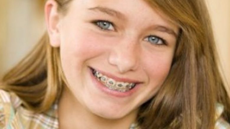 Provocările purtătorilor de aparat dentar: greșeli comune și soluții eficiente