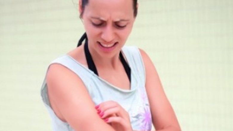 Muşeţelul: Soluţia Naturală pentru Urticarie – Tot Ce Trebuie Să Ştii
