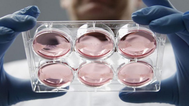 Cauzele eşecului fertilizării in vitro: o privire detaliată asupra provocărilor și soluțiilor