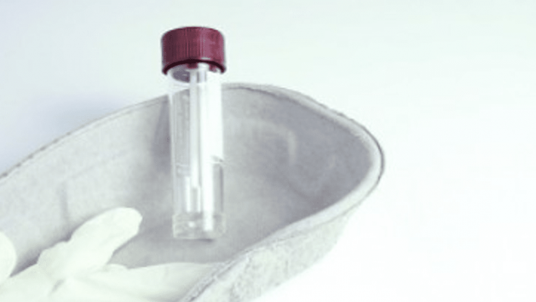 Importanța Examenului Coproparazitologic: O Analiză Detaliată a Rolului Său în Diagnosticarea Parazitozelor Intestinale