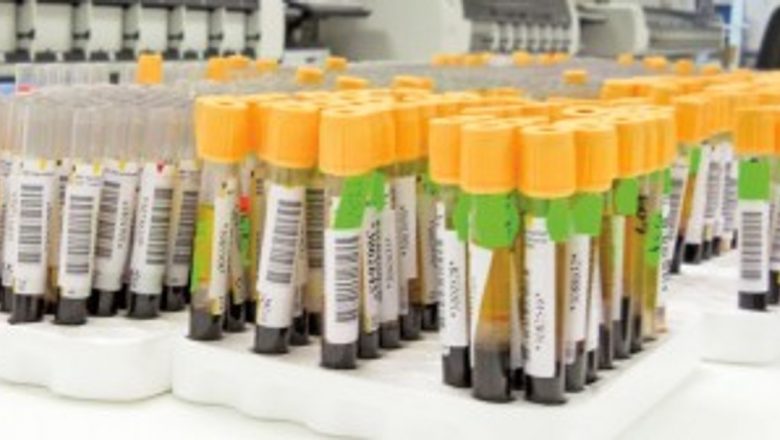Importanța Analizelor de Sânge: Ce Teste Trebuie să Faci pentru a-ți Menține Sănătatea