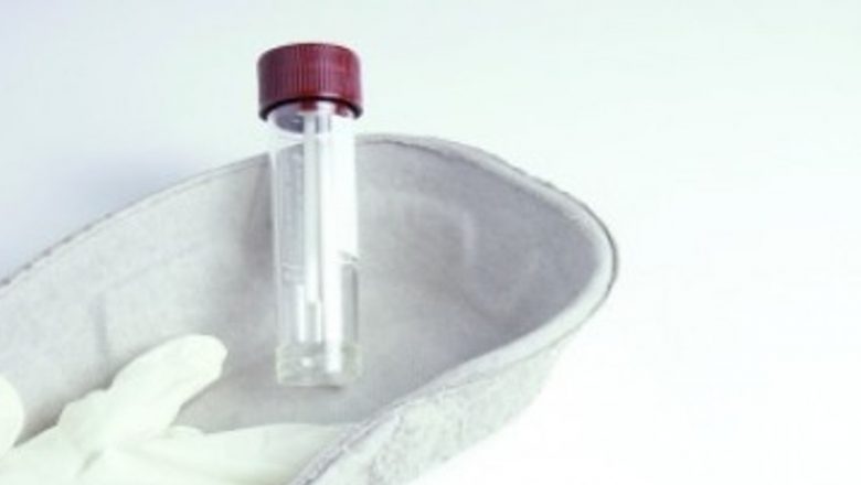Importanța Examenului Coproparazitologic: O Analiză Detaliată a Rolului Său în Diagnosticarea Parazitozelor Intestinale