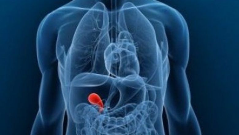 Inflamația Căilor Biliare: O Analiză Detaliată a Angiocolitei și Implicațiile Sale