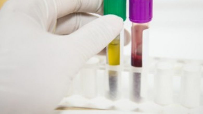 Importanța analizelor medicale în diagnosticarea bolilor de rinichi: un ghid detaliat